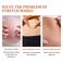 Natural Ingredients Stretch Mark Cream &ndash; Skin Elasticity Support &amp; Scar Repair Moisturizer for Smooth, Firm &amp; Even-Looking Skin