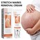 Natural Ingredients Stretch Mark Cream &ndash; Skin Elasticity Support &amp; Scar Repair Moisturizer for Smooth, Firm &amp; Even-Looking Skin