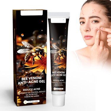 Bee Venom Acne Cream 20g &ndash; Anti-Acne Facial Treatment Cream for Pimple-Prone Skin, Moisturizing Skin Care &amp; Blemish Appearance Reduction