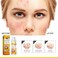 Pimple Treatment Cream &ndash; Gentle Acne &amp; Blemish Care Face Cream for Brightening, Skin Nourishing &amp; Smooth Even-Looking Complexion