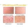 Pimple Treatment Cream &ndash; Gentle Acne &amp; Blemish Care Face Cream for Brightening, Skin Nourishing &amp; Smooth Even-Looking Complexion