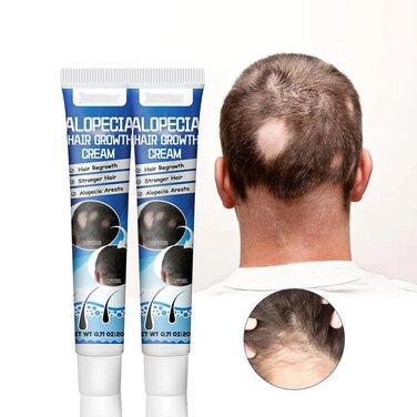 Hair Growth &amp; Thickening Cream for Thinning Hair &ndash; Natural Scalp Treatment Paste to Support Fuller, Stronger Hair for Men &amp; Women, 20g