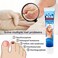 Nail Repair Cream for Stronger Nails &ndash; Nourishing Treatment for Damaged, Aging &amp; Brittle Nails, Supports Healthy Nail Growth &amp; Care