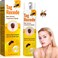 Bee Venom Skin Care Spray &ndash; Targeted Skin Smoothing Treatment for Blemish-Prone Areas, Lightweight Skin Renewal &amp; Care Solution, 20ml