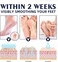 Anti Crack Repair Hand &amp; Foot Cream &ndash; Intensive Moisturizing Cream for Dry, Cracked Skin Relief, Softening &amp; Daily Skin Repair Care