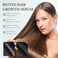 Biotin Hair Growth Spray 30ml &ndash; Thickening Herbal Hair Serum for Hair Regrowth, Anti Hair Loss Treatment, Scalp Nourishing Essence