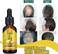 Ginger Hair Growth Serum &ndash; Anti Hair Loss Oil for Stronger, Thicker, Longer Hair, Scalp Nourishing Treatment for Hair Regrowth
