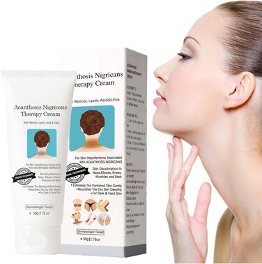 Hyperpigmentation Cream for Dark Neck, Underarms &amp; Intimate Areas &ndash; Skin Brightening Treatment for Uneven Tone, Knees &amp; Bikini Zone