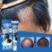 Hair Regrowth Scalp Cream for Thinning Hair &amp; Bald Spots &ndash; Herbal Treatment for Hair Loss, High Hairline Support, Scalp Nourishing Formula
