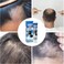 Hair Regrowth Scalp Cream for Thinning Hair &amp; Bald Spots &ndash; Herbal Treatment for Hair Loss, High Hairline Support, Scalp Nourishing Formula