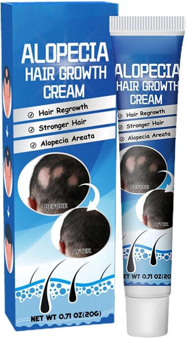 Hair Regrowth Scalp Cream for Thinning Hair &amp; Bald Spots &ndash; Herbal Treatment for Hair Loss, High Hairline Support, Scalp Nourishing Formula