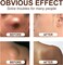 Herbal Skin Care Cream for Makeup Removal &amp; Uneven Skin Texture &ndash; Nourishing Moisturizing Cream for Smooth, Clear-Looking Skin