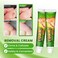 Foot Corn &amp; Callus Removal Cream &ndash; Dead Skin Softening Treatment for Hard Skin, Heel Care Ointment for Smooth Feet &amp; Comfort Relief