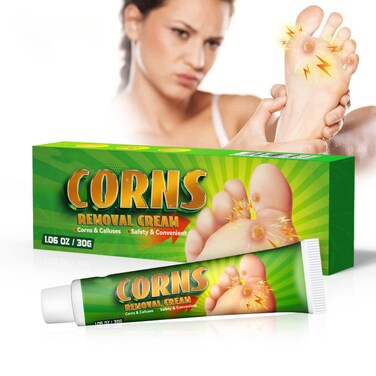 Foot Corn &amp; Callus Removal Cream &ndash; Dead Skin Softening Treatment for Hard Skin, Heel Care Ointment for Smooth Feet &amp; Comfort Relief
