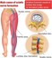 Cooling Herbal Gel Spray for Back, Neck &amp; Joint Comfort &ndash; Soothing Muscle Relaxation Spray for Lumbar, Knee &amp; Cervical Area Care