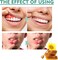 Fast Acting Dental Pain Relief Spray &ndash; Toothache &amp; Gum Soothing Oral Spray for Temporary Oral Discomfort Relief, Portable Oral Care Solution for Adults