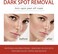 Skin Tone Correcting Serum &ndash; Brightening Facial Moisturizer for Dark Spot Appearance Care, Uneven Skin Tone Support &amp; Radiance Face Serum