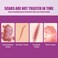 Skin Repair Regeneration Cream &ndash; Scar &amp; Acne Mark Care Body Cream for Skin Renewal, Smoothing &amp; Moisturizing Daily Skin Repair Treatment