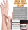 Skin Brightening Cream for Dark Spots, Even Tone Moisturizer for Face &amp; Body, Underarms, Neck, Knees &amp; Inner Thigh Care