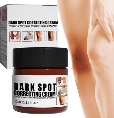 Skin Brightening Cream for Dark Spots, Even Tone Moisturizer for Face &amp; Body, Underarms, Neck, Knees &amp; Inner Thigh Care