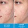 Acne Care Skin Clarifying Cream for Face, Blemish Control &amp; Oil Balance Treatment, Herbal Skin Purifying Cream for Acne-Prone Skin