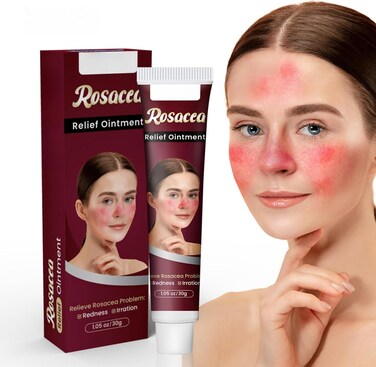 Soothing Redness Relief Cream for Sensitive Skin, Calming Skin Care Ointment for Irritation &amp; Redness Appearance Support, Hydrating Skin Balance Cream 30g