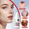 Kojic Acid Face Serum with Hyaluronic Acid, Hydrating Brightening Serum for Dark Spots, Dry Skin Repair and Even Skin Tone