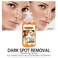 Vitamin C Brightening Body Serum with Glutathione, Nourishing Skin Tone Correcting Serum for Radiant, Smooth &amp; Hydrated Skin