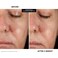 Kate Somerville KateCeuticals® Resurfacing Overnight Peel – Clinic-Grade Face Peel, Powerful Anti-Aging Treatment, 1 Fl Oz - 30ml