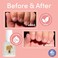 Ella+Mila Nail Care, No More Biting - Stop Nail Biting And Thumb Sucking