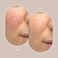 Trophy Skin Large Diamond Tip - Trophy Skin Microdermabrasion