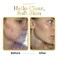 Luxebeauty Luxe Beauty: Luxe Lotion - Hyaluronic Acid Luxurious Face, Neck &amp; Hand Moisturizer