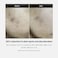 Medicube Deep Vita C Serum 2.0    14.5% Pure Vitamin C Reduce The Appearance Of Hyperpigmentation, Dark Spots, And Blemishes, 16 Self-Tests Complete, Korean Skincare (10G * 3 Bottles)