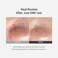 Sungboon Editor Blackhead Melting Clear Pad 65G(30 Counts), Blackhead Remover Pad, Pore Minimizing, Deep Cleansing &amp; Pore Unclogging, Clears Blackhaed, Korean Skincare