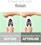 [Mixsoon] Cicatree Clean Toner 5.07 fl oz/150ml   Daily Toner for Troubled Skin, Fast Absorption, Zero Irritation   Cruelty-Free