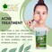 Bliss of Earth Zinc Oxide Powder, 113g - DIY Skin Care Mineral Powder for Face Creams &amp; Sunscreens