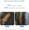 Be Bodywise Rosemary Hair Growth Serum (Roll On), Promotes Hair Growth, Stimulates Hair Follicles, 3% Rosemary, 3% Redensyl &amp; 2% Anagain, Hair Fall Control SerumI Women &amp; Men, All Hair Types, 25 ml