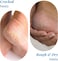 Be Bodywise 20% Urea Foot Cream Roll On, Repairs Dry &amp; Cracked Heels, 2% Lactic Acid, Olive Oil &amp; Vitamin E, Exfoliates &amp; Softens Skin, Hydrates &amp; Moisturises, No Irritation, All Skin Types, 50 ml