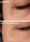 Strivectin Superc Dark Circle Brightening Eye Serum, Lightweight Gel Serum, Visibly Brightens And Corrects Dark Circles