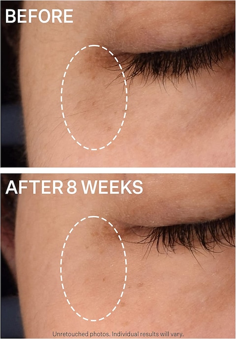 Strivectin Superc Dark Circle Brightening Eye Serum, Lightweight Gel Serum, Visibly Brightens And Corrects Dark Circles