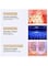 Electric Face Slimming V line Intelligent Face-Lifting Instrument- Face‑Lifting Device - Slimming Vibration Double‑Chin Reducer for Tightening Skin Double Chin Red Blue LED with Remote Control White