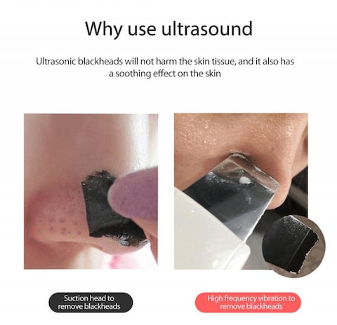 USB Ultrasonic Blackhead Remover Pore Blackhead Remover Facial Cleansing Tool