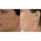 NuBrilliance Hairless Ultimate Painfree Hair Remover, Rose Gold