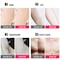 Carevas-Mini Handheld Laser Hair Remover Household Facial Permanent Hair Removal Device Whole Body Laser Hair Remover Machine