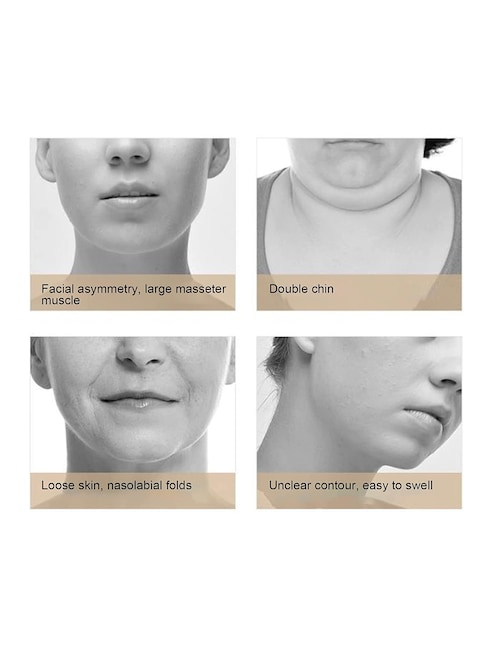 Electric Face Slimming V line Intelligent Face-Lifting Instrument- Face‑Lifting Device - Slimming Vibration Double‑Chin Reducer for Tightening Skin Double Chin Red Blue LED with Remote Control White