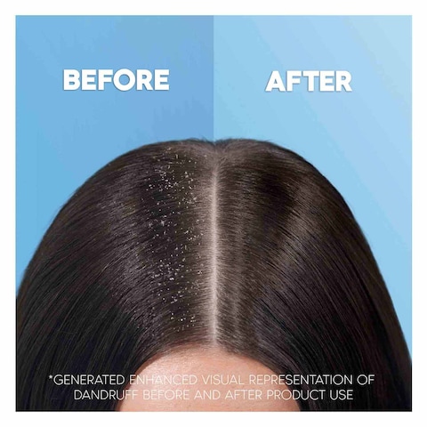 Head And Shoulder 2 In 1 Citrus Fresh Anti Dandruff Shampoo And Conditioner 750ml