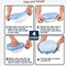 Generic 6Pcs Sets Universal Silicone Stretch Suction Lid-Bowl Pot Lids Fresh-Keeping Cover