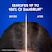 Head &amp; Shoulders Menthol Refresh Anti-Dandruff Shampoo 1000ml Pack of 2