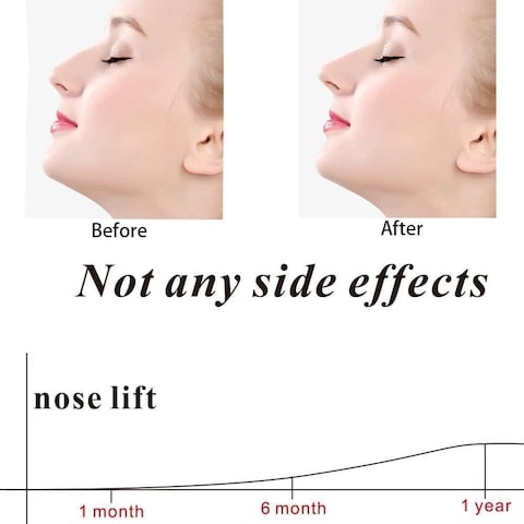Nose Clip Nose Up Lifting Silicone Nose Bridge Straightener Corrector Slimming Device for Wide Crooked Nose High Up Tool