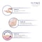 Yutika SPF 30 PA+++ UVA And UVB Protection Sunscreen Lotion 100ml